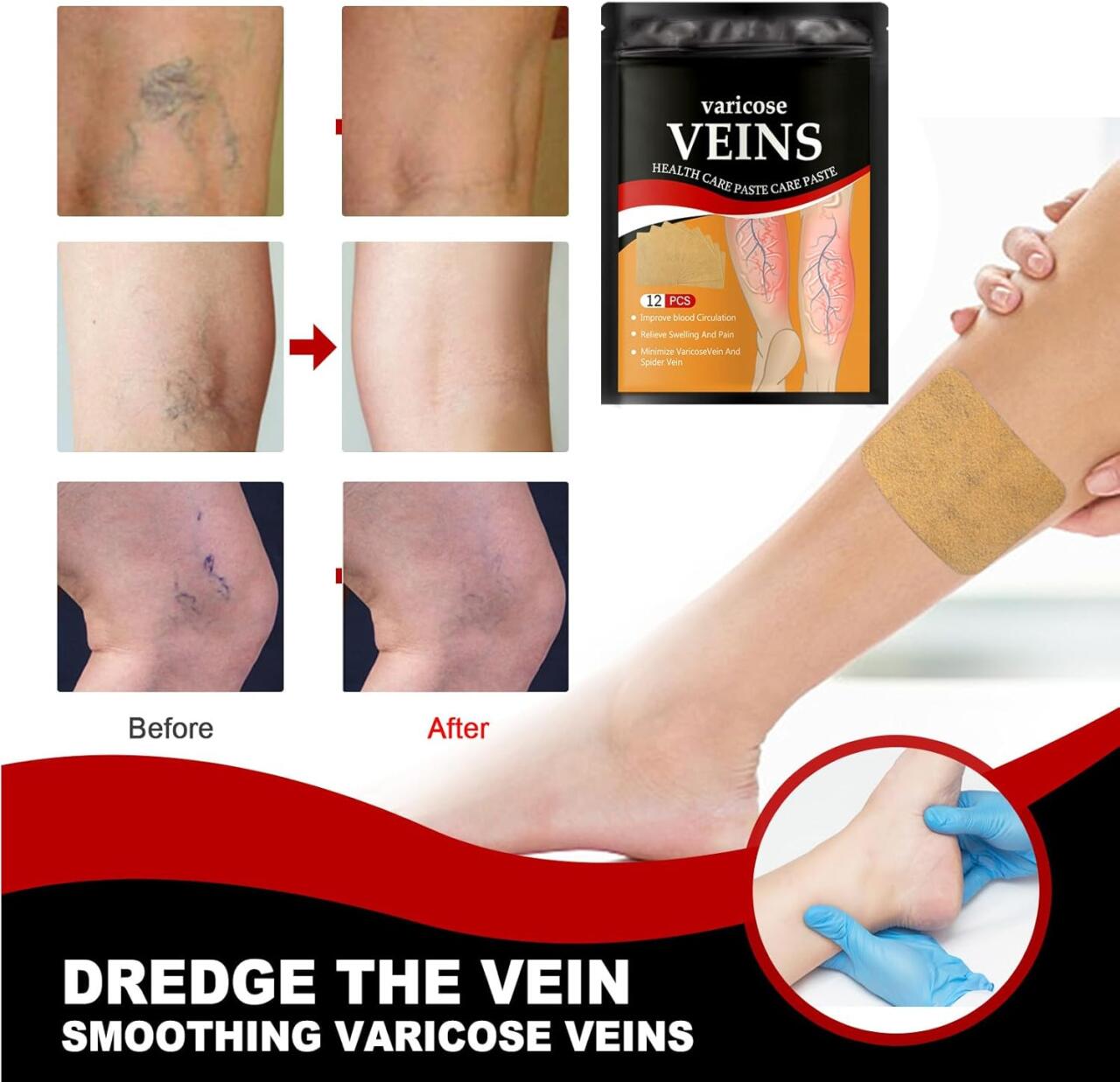 Pack 24 Parches Para El Cuidado De Las Venas